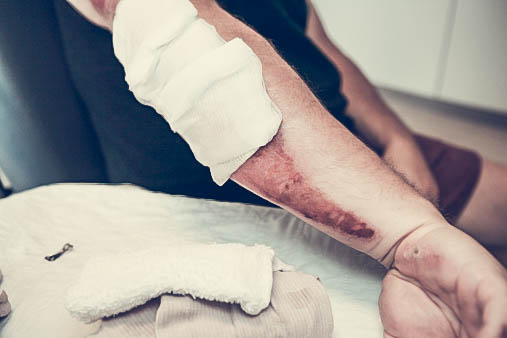 Wound Care